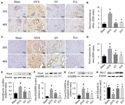 Corrigendum: Antioxidant Effect of Fructus Ligustri Lucidi Aqueous Extract in Ovariectomized Rats Is Mediated through Nox4-ROS-NF-κB Pathway